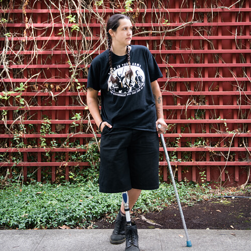 An Indigenous Two-Spirit person with a prosthetic leg standing in front of a vine-covered red wall.